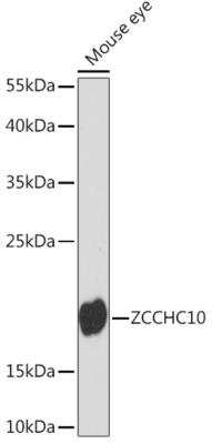 Western Blot: ZCCHC10 Antibody [NBP2-94623] - Western blot analysis of extracts of Mouse eye, using ZCCHC10 antibody at 1:1000 dilution. Secondary antibody: HRP Goat Anti-Rabbit IgG (H+L) at 1:10000 dilution.Lysates/proteins: 25ug per lane. Blocking buffer: 3% nonfat dry milk in TBST.Detection: ECL Basic Kit. Exposure time: 90s.