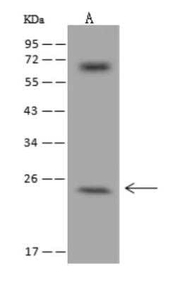 Western Blot: ZCCHC10 Antibody [NBP3-06032] - Anti-ZCCHC10 rabbit polyclonal antibody at 1:500 dilution Lane A: Jurkat Whole Cell Lysate Lysates/proteins at 30 ug per lane. Secondary: Goat Anti-Rabbit IgG (H+L)HRP  at 110000 dilution. Developed using the ECL technique. Performed under reducing conditions. Predicted band size:21 kDaObserved band size:24 kDa (We are unsure as to the identity of these extra bands.)