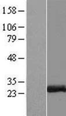 Western Blot ZCCHC10 Overexpression Lysate