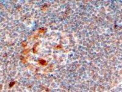 Immunohistochemistry-Paraffin: ZCCHC11/TUT4 Antibody [NB100-783] - Staining of paraffin embedded Human Lymph Node. Antibody at 4 ug/mL. Steamed antigen retrieval with citrate buffer pH 6, HRP-staining.
