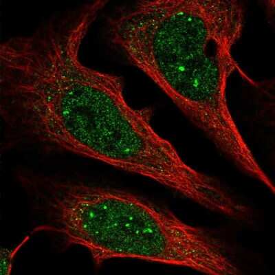 Immunocytochemistry/Immunofluorescence: ZCCHC12 Antibody [NBP2-33943] - Immunofluorescent staining of human cell line U-2 OS shows localization to nuclear bodies.