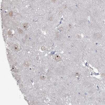 Immunohistochemistry-Paraffin: ZCCHC12 Antibody [NBP2-33943] - Staining of human hippocampus shows distinct nucleolar positivity in neuronal cells.