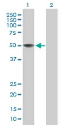 Western Blot: ZCCHC12 Antibody [H00170261-B01P] - Analysis of ZCCHC12 expression in transfected 293T cell line by ZCCHC12 polyclonal antibody.  Lane 1: ZCCHC12 transfected lysate(44.22 KDa). Lane 2: Non-transfected lysate.