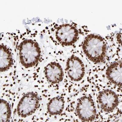 Immunohistochemistry-Paraffin: ZCCHC16 Antibody [NBP1-81888] - Staining of human colon shows strong nuclear positivity in glandular cells.