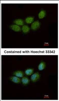 Immunocytochemistry/ Immunofluorescence ZCCHC4 Antibody - BSA Free