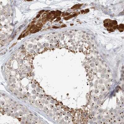 Immunohistochemistry-Paraffin ZCCHC4 Antibody - BSA Free