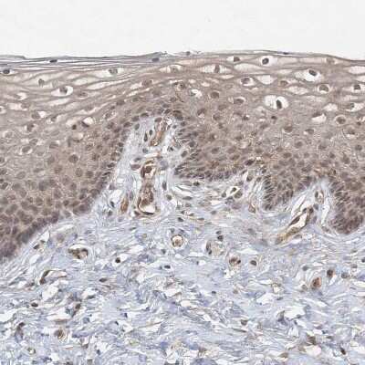 Immunohistochemistry-Paraffin: ZCCHC4 Antibody [NBP1-82094] - Staining of human cervix, uterine shows weak to moderate cytoplasmic and nuclear positivity in squamous epithelial cells.