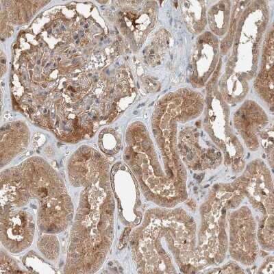 Immunohistochemistry-Paraffin: ZCCHC4 Antibody [NBP1-82094] - Staining of human kidney shows moderate cytoplasmic positivity in cells in tubules.