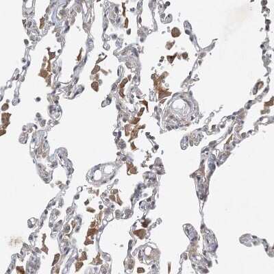 Immunohistochemistry-Paraffin: ZCCHC4 Antibody [NBP1-82094] - Staining of human lung shows moderate cytoplasmic positivity in macrophages.