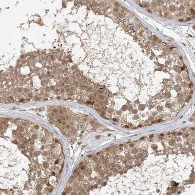 Immunohistochemistry-Paraffin: ZCCHC4 Antibody [NBP1-82094] - Staining of human testis shows moderate cytoplasmic and nuclear positivity in cells in seminiferous ducts.