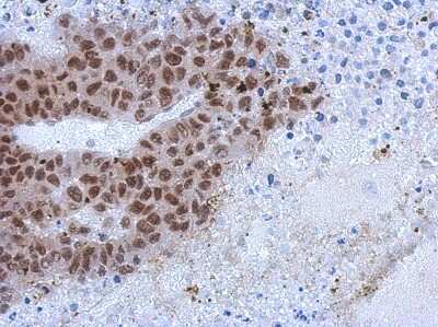 Immunohistochemistry-Paraffin ZCCHC4 Antibody - BSA Free