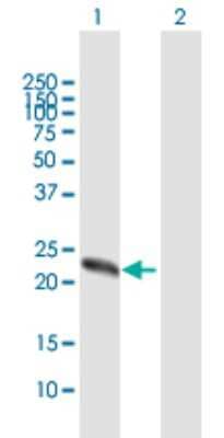 Western Blot ZCCHC4 Antibody - Azide and BSA Free
