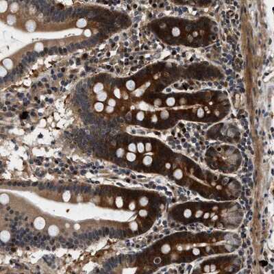 Immunohistochemistry-Paraffin: ZCCHC6 Antibody [NBP1-82258] - Staining of human duodenum shows strong cytoplasmic and nuclear positivity in glandular cells. Paneth cells were negative.