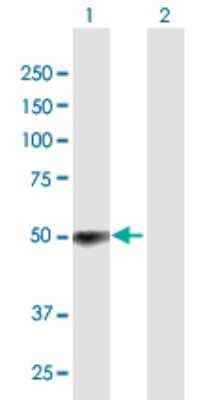 Western Blot: ZCCHC6 Antibody [H00079670-B01P] - Analysis of ZCCHC6 expression in transfected 293T cell line by ZCCHC6 polyclonal antibody.  Lane 1: ZCCHC6 transfected lysate(45.32 KDa). Lane 2: Non-transfected lysate.