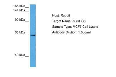 Western Blot: ZCCHC6 Antibody [NBP2-88611] - Host: Rabbit. Target Name: ZCCHC6. Sample Tissue: Human MCF7 Whole Cell lysates. Antibody Dilution: 1ug/ml