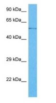 Western Blot: ZCCHC7 Antibody [NBP3-09396] - Western blot analysis of ZCCHC7 in Human Lymph Node Tumor lysates. Antibody dilution at 1ug/ml