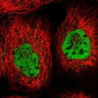 Immunofluorescence ZCCHC8 Antibody