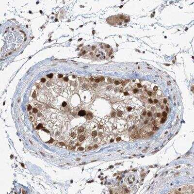 Immunohistochemistry ZCCHC8 Antibody