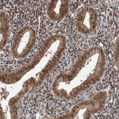 Immunohistochemistry ZCCHC8 Antibody