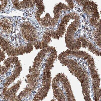 Immunohistochemistry ZCCHC8 Antibody