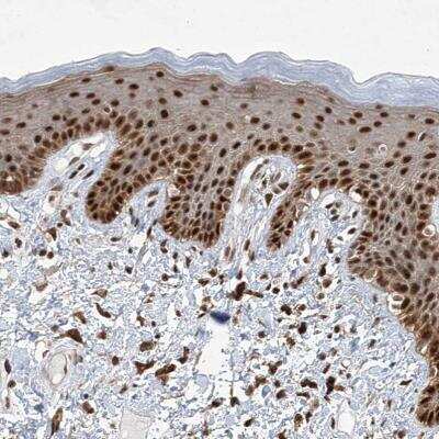Immunohistochemistry ZCCHC8 Antibody