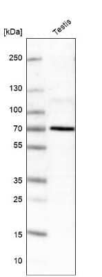 Western Blot ZCCHC8 Antibody