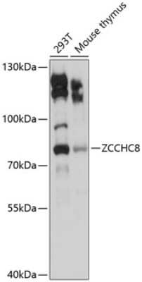 Western Blot: ZCCHC8 Antibody [NBP2-93302] - Analysis of extracts of various cell lines, using ZCCHC8 at 1:3000 dilution. Secondary antibody: HRP Goat Anti-Rabbit IgG (H+L) at 1:10000 dilution. Lysates/proteins: 25ug per lane. Blocking buffer: 3% nonfat dry milk in TBST. Detection: ECL Basic Kit . Exposure time: 15s.