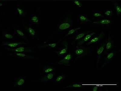 Immunocytochemistry/Immunofluorescence: ZCCHC9 Antibody [H00084240-B01P] - Analysis of purified antibody to ZCCHC9 on HeLa cell. (antibody concentration 10 ug/ml)