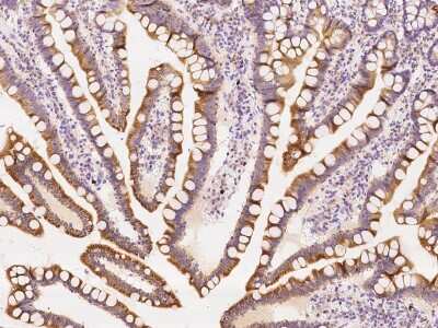 Immunohistochemistry-Paraffin: ZCCHC9 Antibody [NBP2-97817] - Staining of human ZCCHC9 in human duodenum with rabbit polyclonal antibody at 1:100 dilution. 