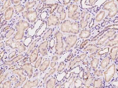 Immunohistochemistry-Paraffin: ZCCHC9 Antibody [NBP2-97817] - Staining of human ZCCHC9 in human kidney with rabbit polyclonal antibody at 1:100 dilution. 