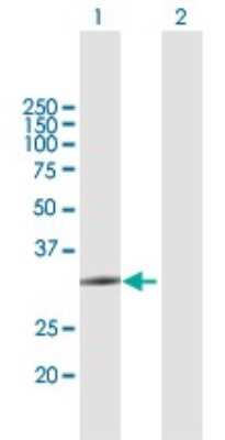 Western Blot: ZCCHC9 Antibody [H00084240-B01P] - Analysis of ZCCHC9 expression in transfected 293T cell line by ZCCHC9 polyclonal antibody.  Lane 1: ZCCHC9 transfected lysate(29.81 KDa). Lane 2: Non-transfected lysate.