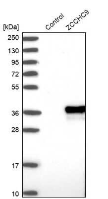 Western Blot: ZCCHC9 Antibody [NBP1-84102] - Analysis in control (vector only transfected HEK293T lysate) and ZCCHC9 over-expression lysate (Co-expressed with a C-terminal myc-DDK tag (3.1 kDa) in mammalian HEK293T cells).