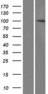 Western Blot: ZCCHV Overexpression Lysate (Adult Normal) [NBP2-06692] Left-Empty vector transfected control cell lysate (HEK293 cell lysate); Right -Over-expression Lysate for ZCCHV.