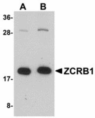 Western Blot: ZCRB1 Antibody [NBP1-72117] - Western blot of ZCRB1 in Raji cell lysate with ZCRB1 antibody at (A) 1 and (B) 2 ug/ml.
