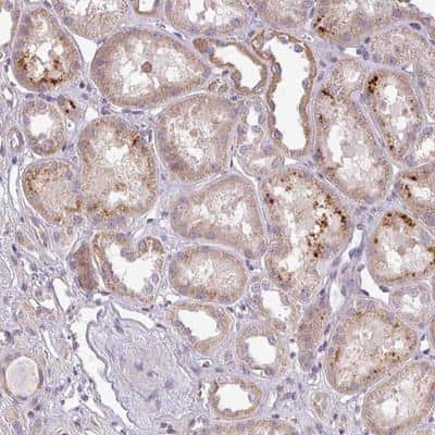 Immunohistochemistry-Paraffin: ZDHHC1 Antibody [NBP2-13539] - Staining of human kidney shows moderate cytoplasmic positivity in cells in tubules.