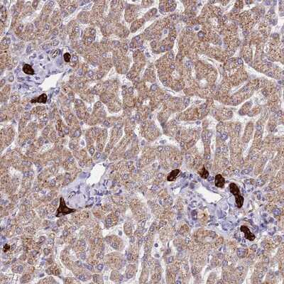Immunohistochemistry-Paraffin ZDHHC1 Antibody - BSA Free
