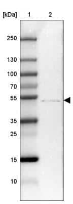 Western Blot: ZDHHC1 Antibody [NBP2-13539] - Lane 1: Marker [kDa] 250, 130, 100, 70, 55, 35, 25, 15, 10Lane 2: Human Tonsil tissue