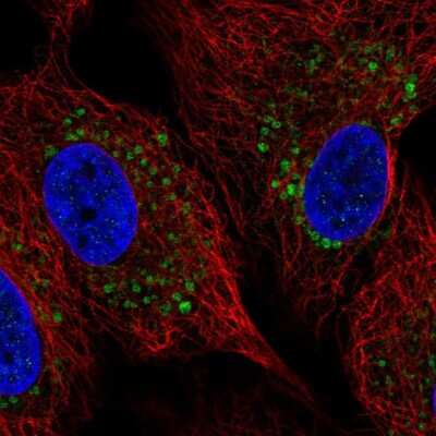 Immunocytochemistry/Immunofluorescence: ZDHHC11 Antibody [NBP2-56597] - Staining of human cell line A549 shows localization to lipid droplets.