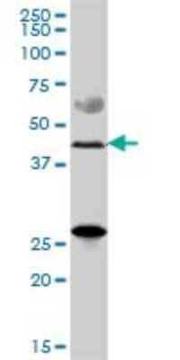 Western Blot: ZDHHC11 Antibody [H00079844-B01P] - Analysis of ZDHHC11 expression in human colon.