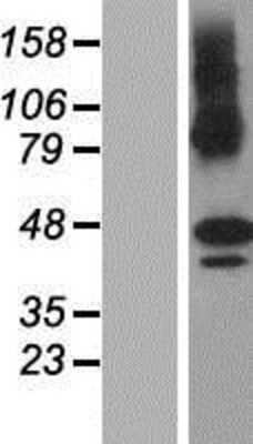 Western Blot: ZDHHC11 Overexpression Lysate (Adult Normal) [NBP2-06281] Left-Empty vector transfected control cell lysate (HEK293 cell lysate); Right -Over-expression Lysate for ZDHHC11.