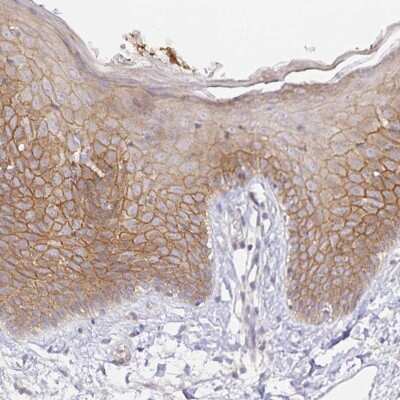 Immunohistochemistry-Paraffin: ZDHHC11/ZDHHC11B Antibody [NBP2-34089] - Staining of human skin shows moderate membranous and cytoplasmic positivity in keratinocytes.