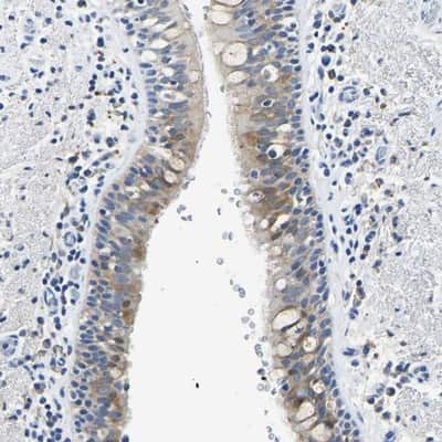 Immunohistochemistry-Paraffin ZDHHC13 Antibody - BSA Free
