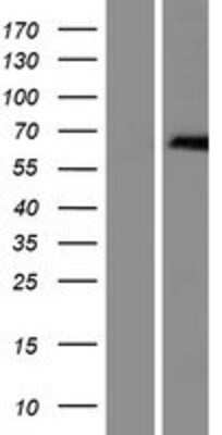Western Blot ZDHHC13 Overexpression Lysate