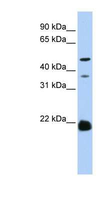 Western Blot: ZDHHC14 Antibody [NBP1-60110] - Hela cell lysate, concentration 0.2-1 ug/ml.