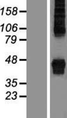 Western Blot: ZDHHC14 Overexpression Lysate (Adult Normal) [NBP2-05224] Left-Empty vector transfected control cell lysate (HEK293 cell lysate); Right -Over-expression Lysate for ZDHHC14.