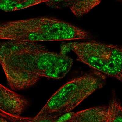 Immunocytochemistry/ Immunofluorescence ZDHHC15 Antibody - BSA Free