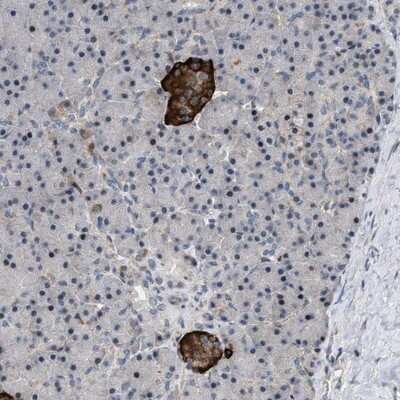 Immunohistochemistry-Paraffin ZDHHC15 Antibody - BSA Free