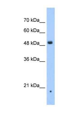 Western Blot: ZDHHC16 Antibody [NBP1-59446] - Jurkat cell lysate, concentration 0.2-1 ug/ml.
