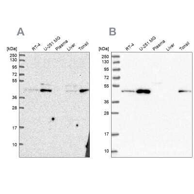 Western Blot: ZDHHC16 Antibody [NBP2-55212] - Analysis using Anti-ZDHHC16 antibody NBP2-55212 (A) shows similar pattern to independent antibody NBP1-89041 (B).