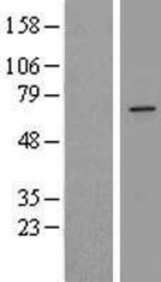 Western Blot: ZDHHC16 Overexpression Lysate (Adult Normal) [NBP2-10078] Left-Empty vector transfected control cell lysate (HEK293 cell lysate); Right -Over-expression Lysate for ZDHHC16.